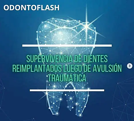 Implantes dentales y rehabilitación oral con tecnología avanzada en odontología en Campus Odontológico.