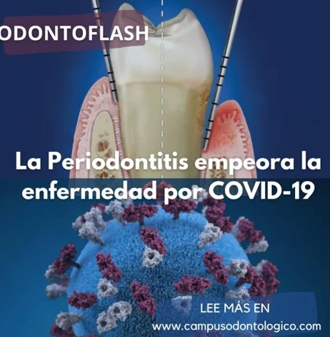 Clínica dental ejecutando tratamiento de encías, con modelo de infección por COVID-19, en imagen educativa sobre salud bucal y prevención de enfermedades periodontales.