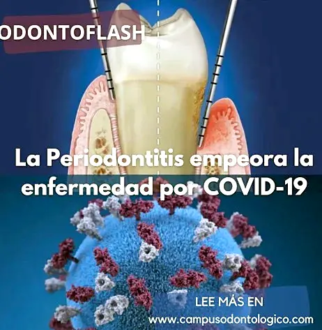 Microbiología y prevención de la periodontitis en pacientes con COVID-19 para odontólogos.