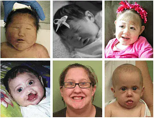 Bebés sonriendo y en brazos con énfasis en odontología pediátrica y cuidado infantil.