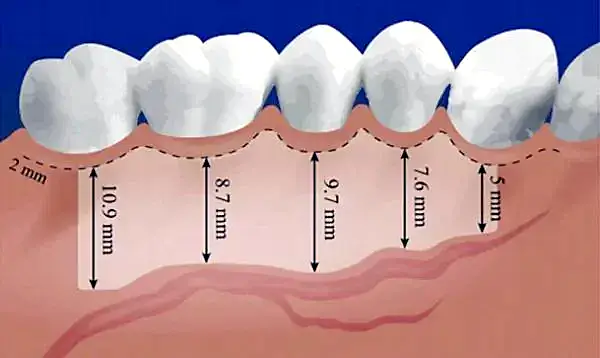 Archivo: estructura-encías-dental.jpg.