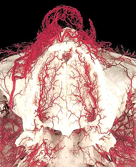 Corte anatómico de un hueso maxilar con red vascular detallada, ilustración médica para estudios dentales y de anatomía ósea.