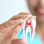 Paciente sonriendo sosteniendo un modelo de diente artificial en mano, representando cuidado dental y prótesis en clínica odontológica.
