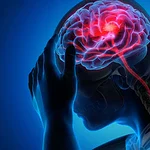 Ilustración de un cerebro con dolor de cabeza, relacionado con cefaleas en odontología, en un contexto médico y dental.